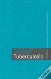 Capa do artigo Clinical Tuberculosis