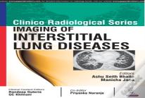 Clinico Radiological Series: Imaging Of Interstitial Lung Diseases
