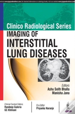 Capa do artigo Clinico Radiological Series: Imaging Of Interstitial Lung Diseases