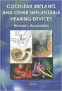 Cochlear Implants Amp Other Implantab - Preview