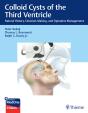 Colloid Cysts Of The Third Ventricle - Preview