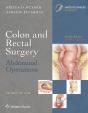 Colon And Rectal Surgery: Abdominal Operations - Preview