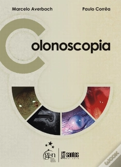 Capa do artigo Colonoscopia