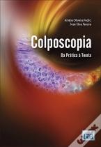 Colposcopia