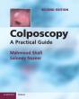 Colposcopy - Preview