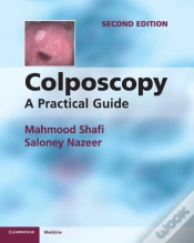 Capa do artigo Colposcopy