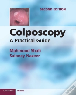 Capa do artigo Colposcopy
