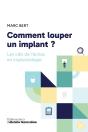 Comment Louper Un Implant : Les Clés De L'Échec En Implantologie - Preview