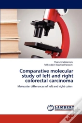 Comparative Molecular Study Of Left And Right Colorectal Carcinoma