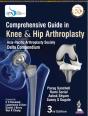 Comprehensive Guide In Knee & Hip Arthroplasty - Preview