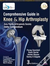 Comprehensive Guide In Knee & Hip Arthroplasty