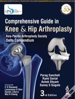 Capa do artigo Comprehensive Guide In Knee & Hip Arthroplasty