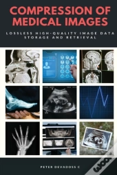 Compression Of Medical Images - Lossless High Quality Image Data Storage And Retrieval