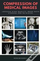 Compression Of Medical Images - Lossless High Quality Image Data Storage And Retrieval