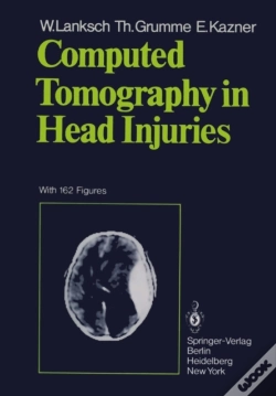 Capa do artigo Computed Tomography In Head Injuries