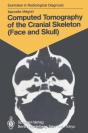 Computed Tomography Of The Cranial Skeleton (Face And Skull) - Preview