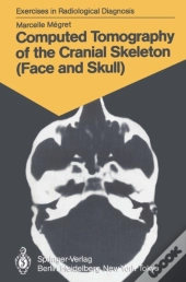 Computed Tomography Of The Cranial Skeleton (Face And Skull)