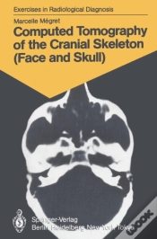 Capa do artigo Computed Tomography Of The Cranial Skeleton (Face And Skull)