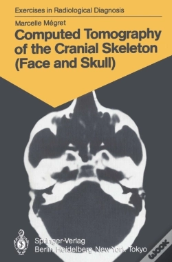 Capa do artigo Computed Tomography Of The Cranial Skeleton (Face And Skull)