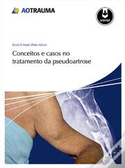 Conceitos e Casos no Tratamento da Pseudoartrose
