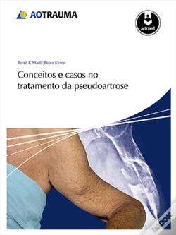 Capa do artigo Conceitos e Casos no Tratamento da Pseudoartrose