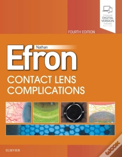 Capa do artigo Contact Lens  Complications