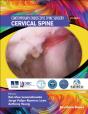 Contemporary Endoscopic Spine Surgery Volume 1: Cervical Spine - Preview