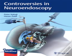 Controversies In Neuroendoscopy