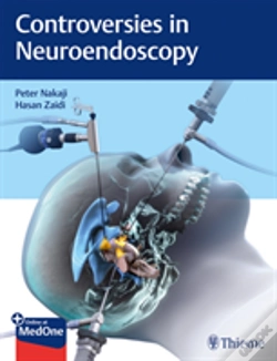 Capa do artigo Controversies In Neuroendoscopy