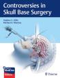 Controversies In Skull Base Surgery - Preview