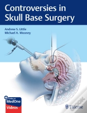 Capa do artigo Controversies In Skull Base Surgery