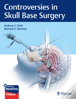 Capa do artigo Controversies In Skull Base Surgery