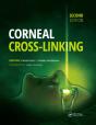 Corneal Cross-Linking - Preview
