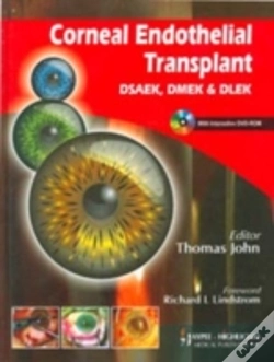 Capa do artigo Corneal Endothelial Transplant