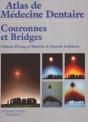 Couronnes Et Bridges - Preview