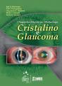 Cristalino e Glaucoma - Preview