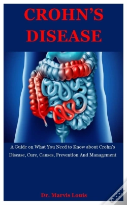 Capa do artigo Crohn'S Disease