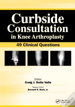 Capa do artigo Curbside Consultation In Knee Arthroplasty