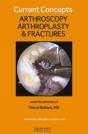 Current Concepts. Arthroscopy, Arthroplasty & Fractures - Preview
