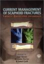 Current Management Of Scaphoid Fractures - Preview