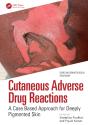 Cutaneous Adverse Drug Reactions - Preview