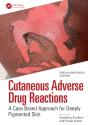Cutaneous Adverse Drug Reactions - Preview