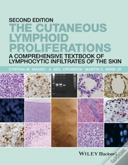 Capa do artigo Cutaneous Lymphoid Proliferations