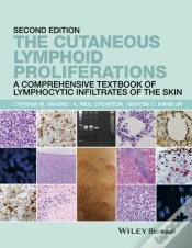 Capa do artigo Cutaneous Lymphoid Proliferations