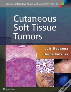 Capa do artigo Cutaneous Soft Tissue Tumors