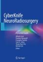 Cyberknife Neuroradiosurgery - Preview