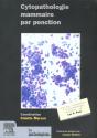 Cythopathologie Des Lesions Du Sein - Preview