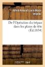 De L'Operation Du Trepan Dans Les Plaies De Tete - Preview