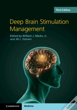 Capa do artigo Deep Brain Stimulation Management