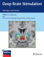 Deep Brain Stimulation - Preview